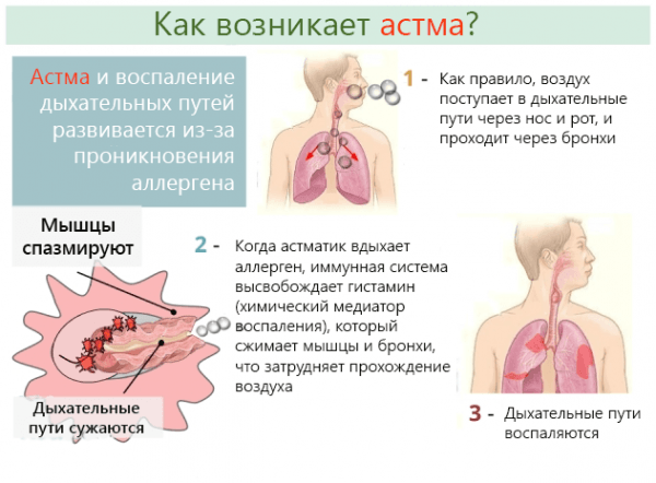 How does asthma occur?