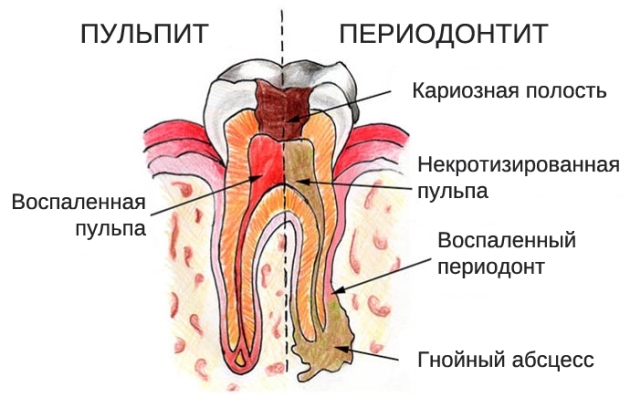 Zubni terapeut. Što čini razliku sa stomatologom, stomatologom-kirurgom, što radi dijete, odrasla osoba