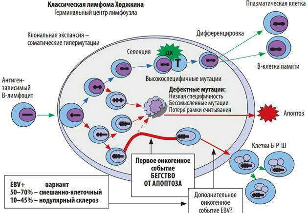 Hodgkin's disease (nodular sclerosis). What is it, analysis, pathogenesis, clinical guidelines