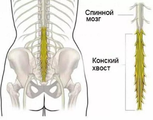 Horse tail spine. Anatomy, photo, symptoms and treatment for men, women