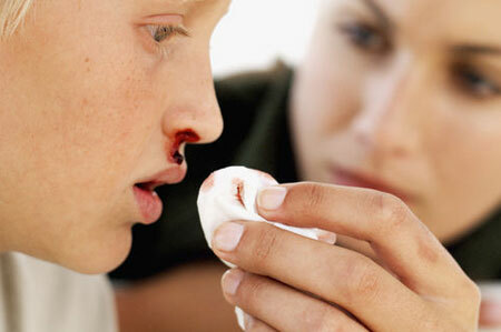 Causes of nasal bleeding in children