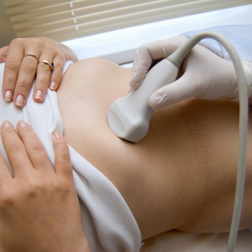 Echografie van het peritoneum bij vrouwen
