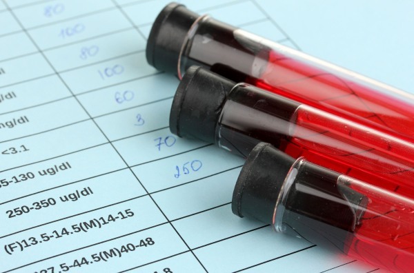 La PCR en la sangre está elevada en un adulto. Causas, la norma en mujeres, hombres.
