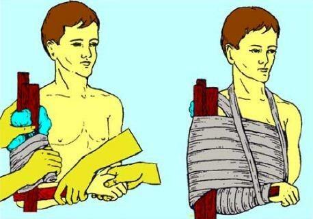 Primeros auxilios para lesiones en el hombro