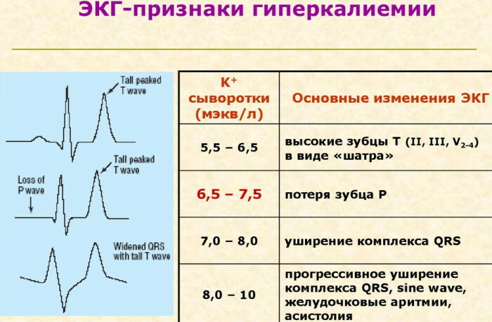 Excess potassium in the body in women. Symptoms after 40-50-60 years, treatment