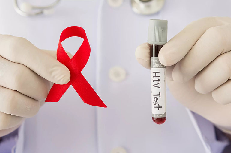 Zakażenie wirusem HIV