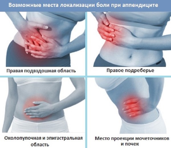 The causes of lower back pain in women, if painful to bend, inflamed sacrum. Treatment of folk remedies