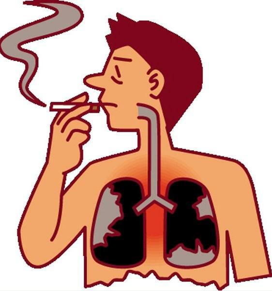 Rūkymas gali sukelti astmą