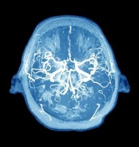 hjerne og tumorer