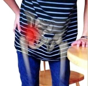 Zovretie nervu v bedrovom kĺbe - hlavnou príčinou bolesti bedier