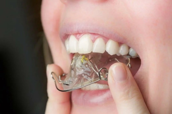Hampaiden kohdistuslevyt lapsille. Hinta, arvostelut