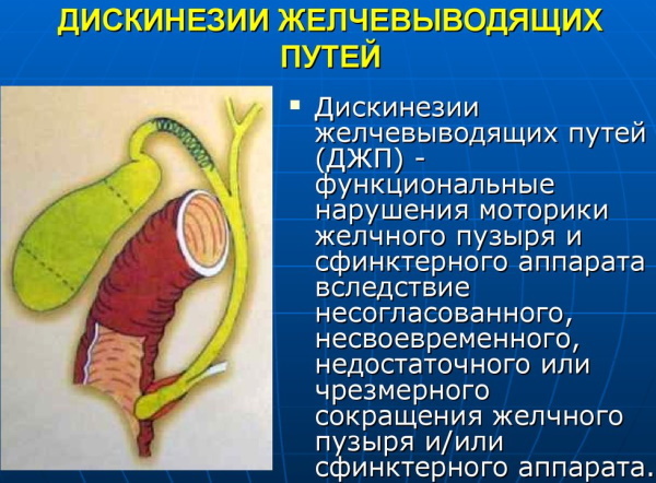 La vésicule biliaire chez l'homme. Où se trouve, photos, fonctions