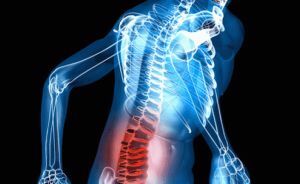 trauma a nervové poškodenie chrbta
