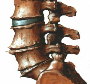 vertebra injury