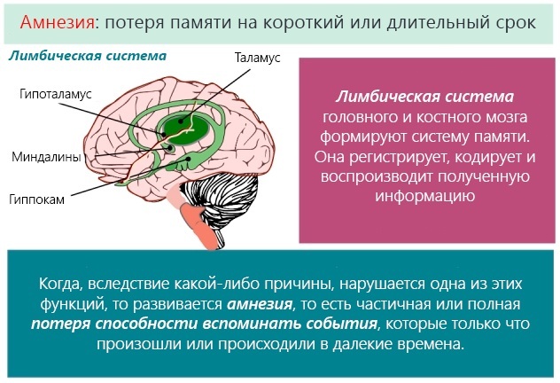 Retrograde amnesia. What is it, causes, treatment for concussion, TBI, injury, schizophrenia