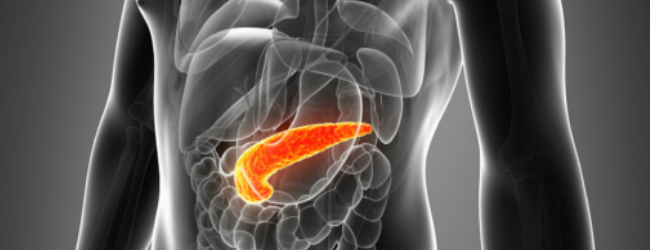 Pot mânca rodie în pancreatită?