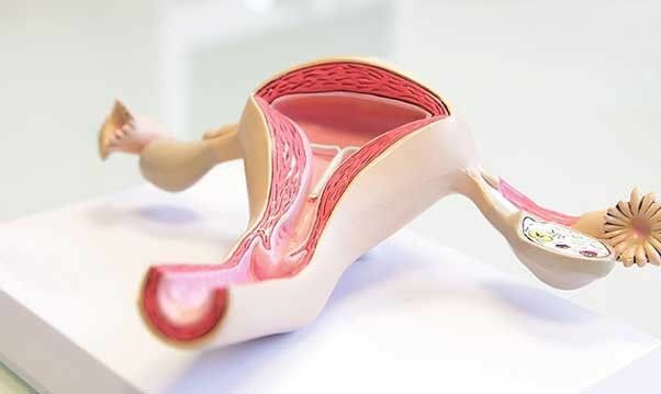 Endometrioid ovariecyst og graviditet