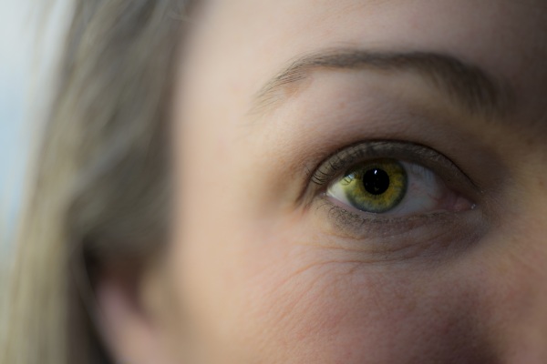 Wolf eyes are yellow in humans. Photos are natural, reasons