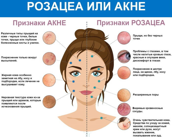 Rosácea: un régimen de tratamiento para mujeres, que es, tratamiento y nutrición