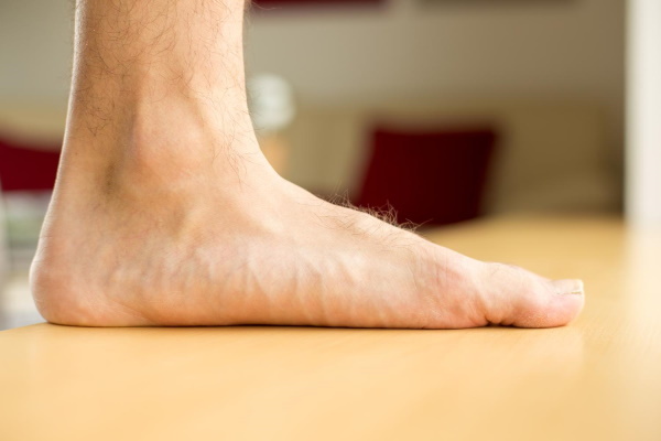 Flat feet 3 degrees. Degrees, symptoms, what it looks like, treatment