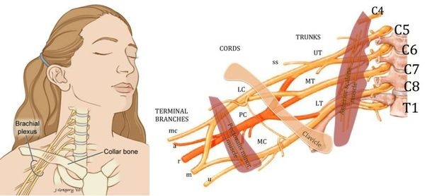 Brachial nerve plexitis. Drug treatment, symptoms