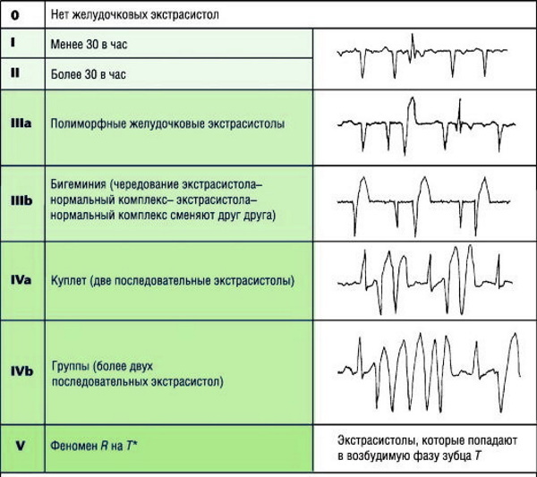 Supraventricular extrasystoles. Rate per day
