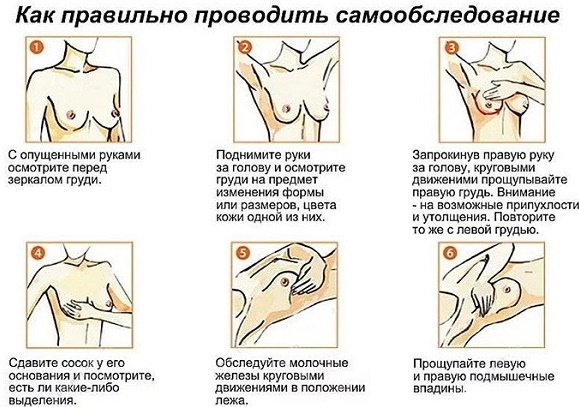 Massage for fibrous mastopathy of the mammary glands