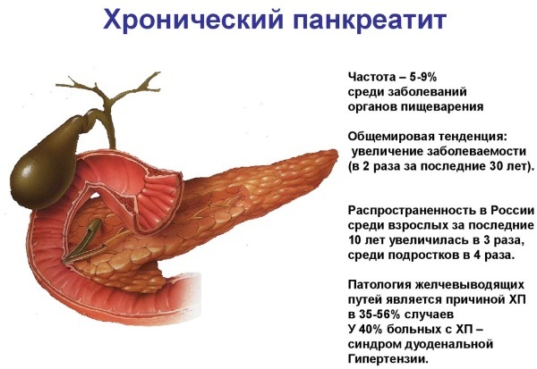 Pancreatitis. Symptoms and Treatment in Adults. Folk remedies, medications, diet. What can not be