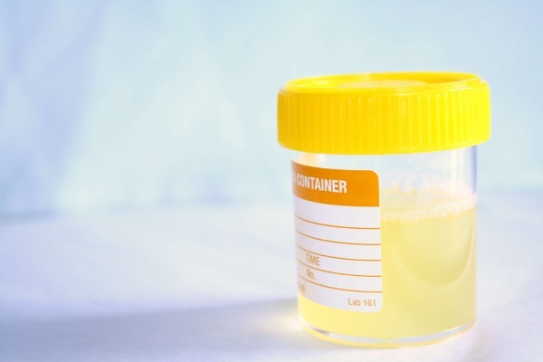 Cloudy urine in a child 2-4 years old, 5-7 years old. Reasons for what to do