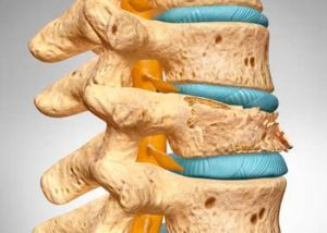 Hoe te stoppen met diffuse osteoporose om niet uitgeschakeld te raken
