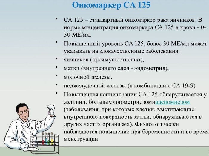 CA-125 tumor marker. The norm in women, what is it, how to take, transcript