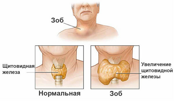Signs of an increase in thyroid