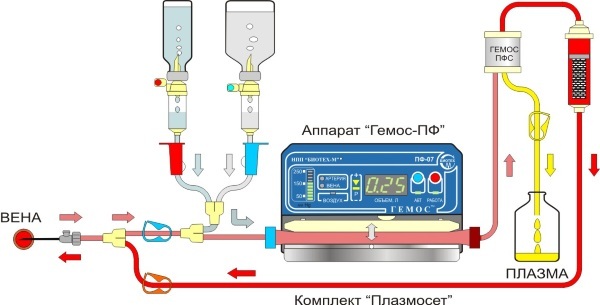 Plasmapheresis blood cleaning. Price, what is it, indications, contraindications