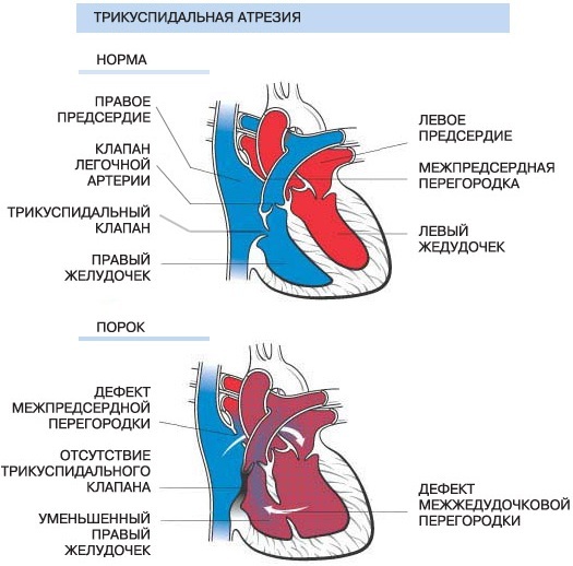 Tricuspid valve of the heart. Where is located, between what, anatomy