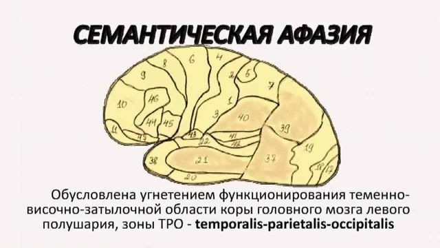 Localizarea leziunilor în creier