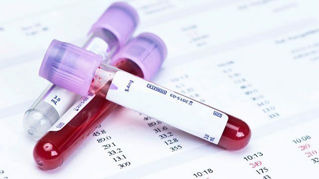 Standardele hormonului TSH din sânge