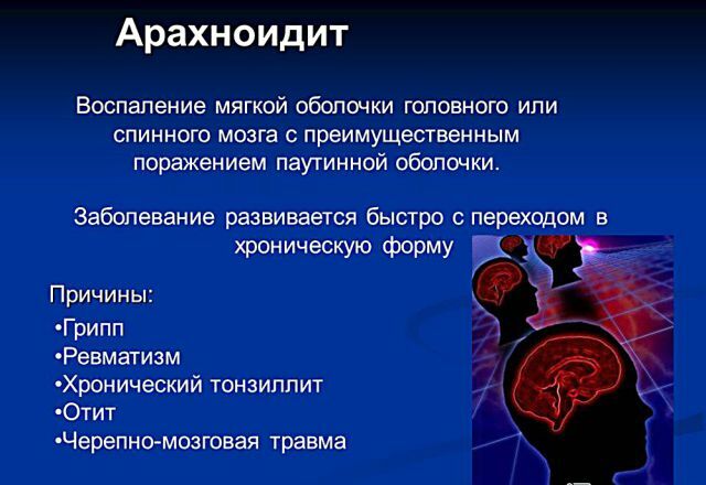 Stuburo ir smegenų aaronoiditas: simptomai ir gydymas