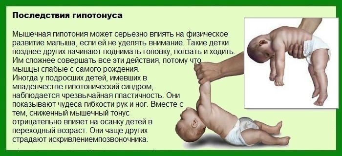 Muscular dystonia in infants, children, adults. What is it, symptoms, treatment