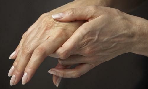 Sinais característicos de artrose