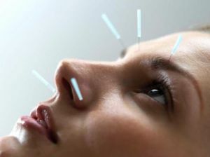 Akupunkturpunkte im Gesicht