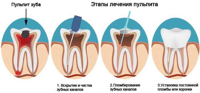 I denti anteriori della mascella superiore fanno male