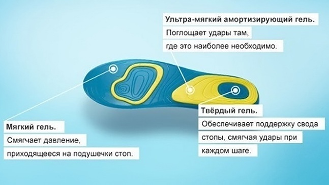 Instep support for the foot with flat feet. Where to buy, how to make, choose, price, photo