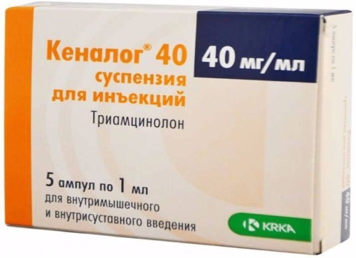 Kenalog. Instructions for use, price of 1 ampoule, reviews