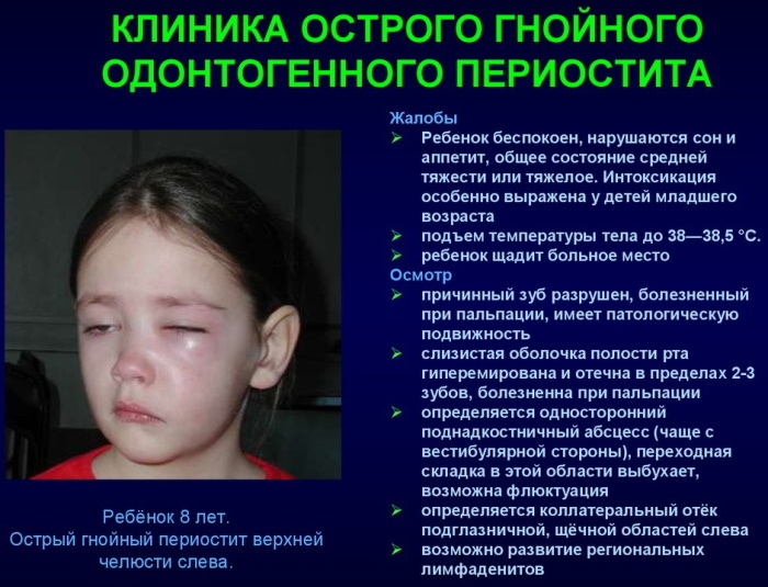 Flux in a child 2-3-4 years old. Photo how to treat