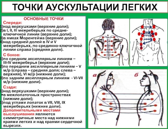 Inflammation of the bronchi. Symptoms in adults without and with fever, treatment