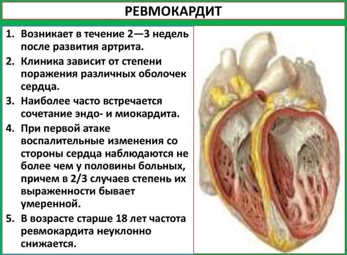 Cardiovascular diseases. List of what it is, symptoms, statistics, what are, causes, prevention