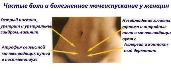 Frequent pain in the lower abdomen in women