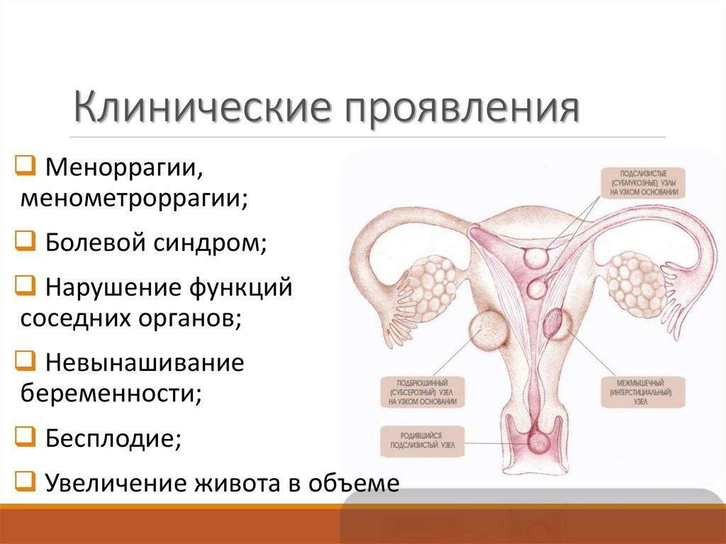Kliniska manifestationer av livmodermoment