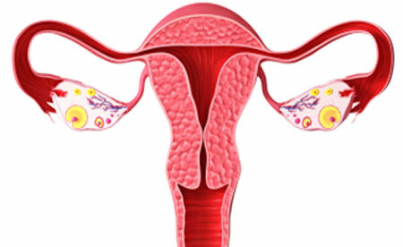 Arten von Menstruationsstörungen
