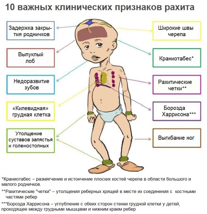 Cold sweat in a child without fever. Causes at night, with cough, on falling asleep, in sleep